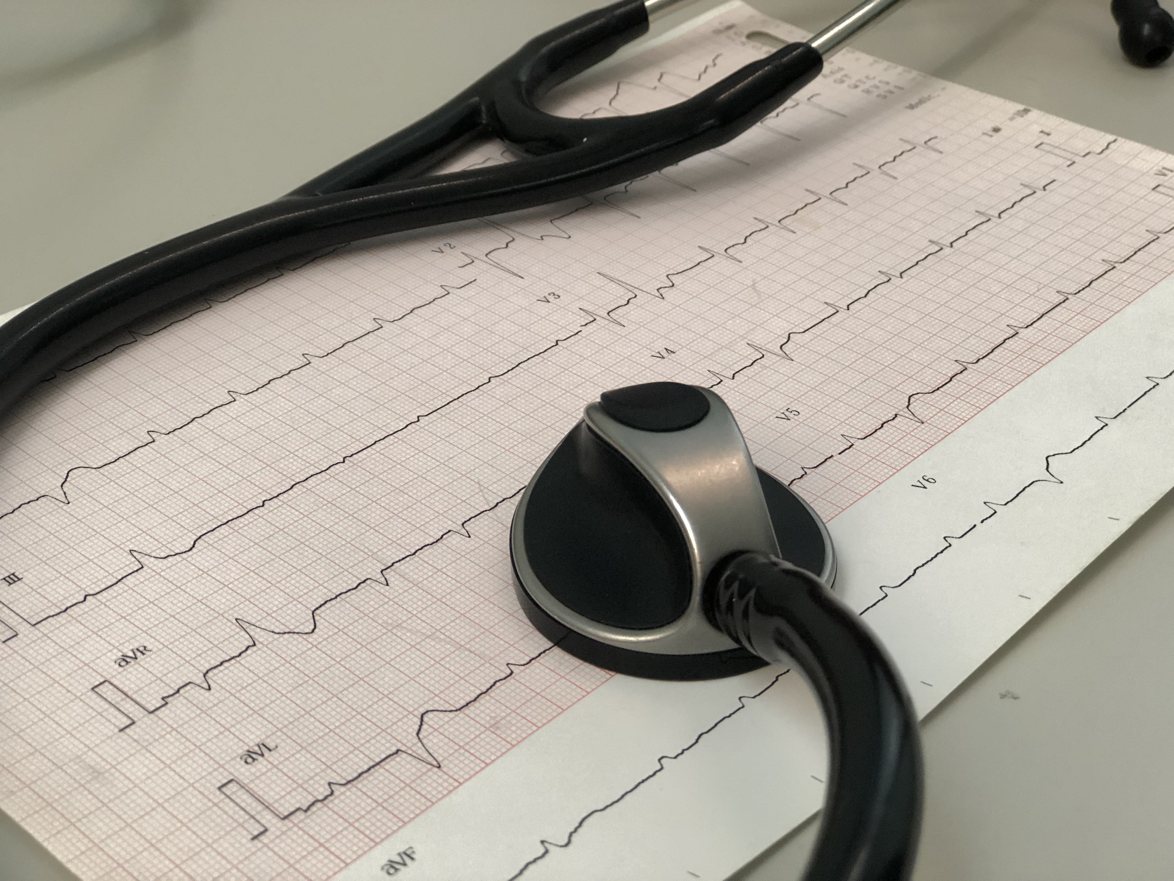 Nova Health EKG